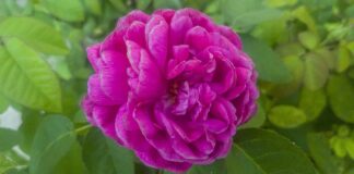 Czy od pakietów medycznych Płacimy ZUS?